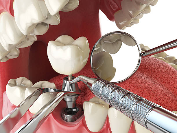 Best Knocked-Out Tooth Emergency  in Robinson, IL